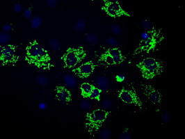 MTRF1L Antibody in Immunocytochemistry (ICC/IF)