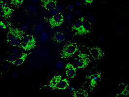 MTRF1L Antibody in Immunocytochemistry (ICC/IF)