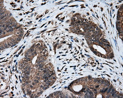 MTRF1L Antibody in Immunohistochemistry (Paraffin) (IHC (P))