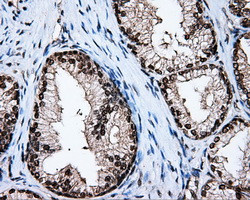 MTRF1L Antibody in Immunohistochemistry (Paraffin) (IHC (P))