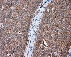 MTRF1L Antibody in Immunohistochemistry (Paraffin) (IHC (P))