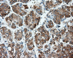 MTRF1L Antibody in Immunohistochemistry (Paraffin) (IHC (P))