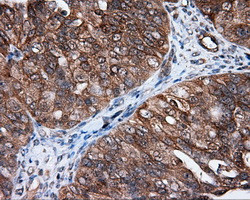 MTRF1L Antibody in Immunohistochemistry (Paraffin) (IHC (P))