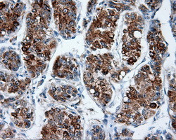 MTRF1L Antibody in Immunohistochemistry (Paraffin) (IHC (P))