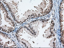 MTRF1L Antibody in Immunohistochemistry (Paraffin) (IHC (P))