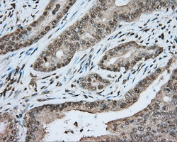 MTRF1L Antibody in Immunohistochemistry (Paraffin) (IHC (P))