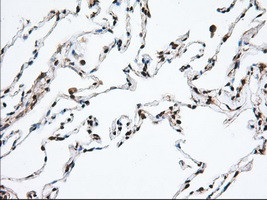 MTRF1L Antibody in Immunohistochemistry (Paraffin) (IHC (P))