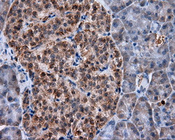 MTRF1L Antibody in Immunohistochemistry (Paraffin) (IHC (P))