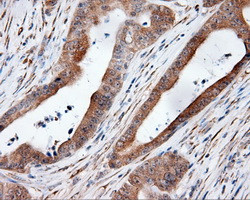 MTRF1L Antibody in Immunohistochemistry (Paraffin) (IHC (P))