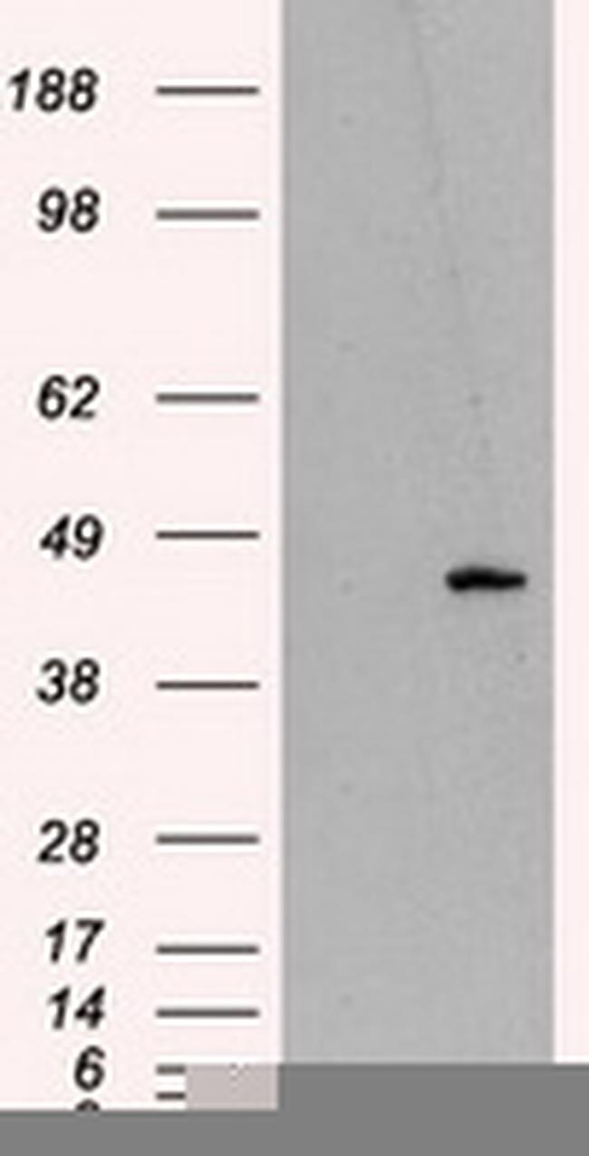 MTRF1L Antibody in Western Blot (WB)