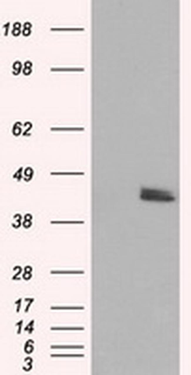 MTRF1L Antibody in Western Blot (WB)