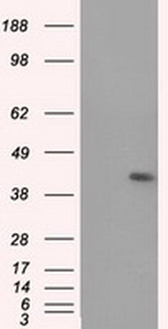 MTRF1L Antibody in Western Blot (WB)