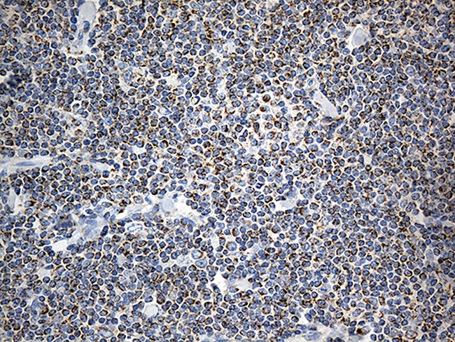 MTX2 Antibody in Immunohistochemistry (Paraffin) (IHC (P))