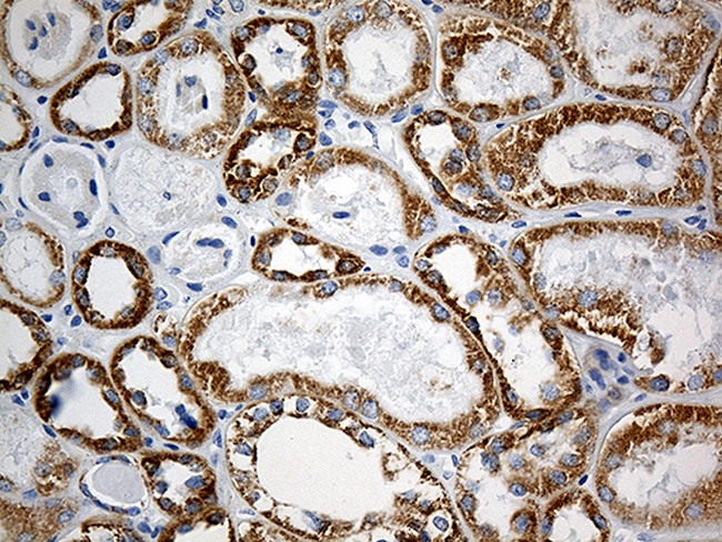 MTX2 Antibody in Immunohistochemistry (Paraffin) (IHC (P))