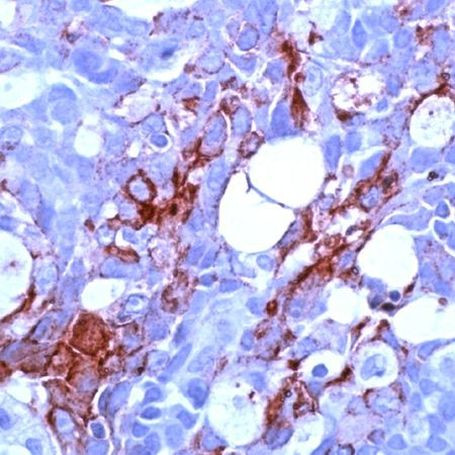 MUC1 Antibody in Immunohistochemistry (Paraffin) (IHC (P))