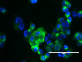 MUC1 Antibody in Immunocytochemistry (ICC/IF)