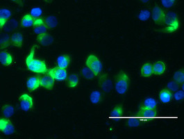 MUC1 Antibody in Immunocytochemistry (ICC/IF)