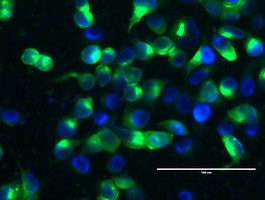 MUC1 Antibody in Immunocytochemistry (ICC/IF)