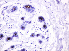 MUC1 Antibody in Immunohistochemistry (Paraffin) (IHC (P))