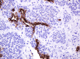 MUC1 Antibody in Immunohistochemistry (Paraffin) (IHC (P))