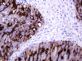 MUC1 Antibody in Immunohistochemistry (Paraffin) (IHC (P))