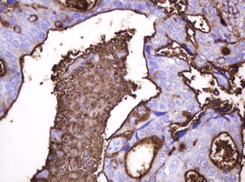 MUC1 Antibody in Immunohistochemistry (Paraffin) (IHC (P))