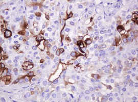 MUC1 Antibody in Immunohistochemistry (Paraffin) (IHC (P))