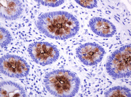 MUC1 Antibody in Immunohistochemistry (Paraffin) (IHC (P))