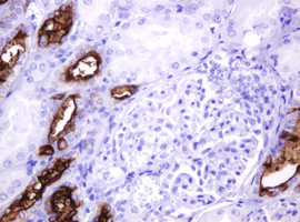 MUC1 Antibody in Immunohistochemistry (Paraffin) (IHC (P))