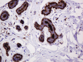 MUC1 Antibody in Immunohistochemistry (Paraffin) (IHC (P))