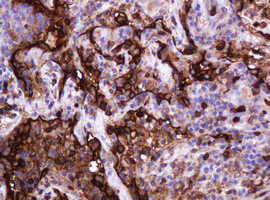 MUC1 Antibody in Immunohistochemistry (Paraffin) (IHC (P))