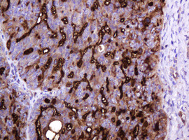 MUC1 Antibody in Immunohistochemistry (Paraffin) (IHC (P))