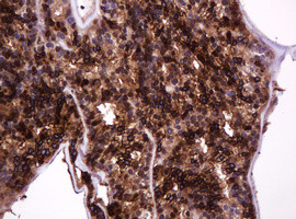 MUC1 Antibody in Immunohistochemistry (Paraffin) (IHC (P))