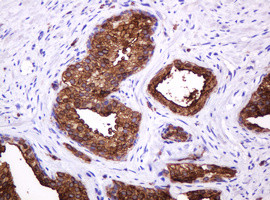 MUC1 Antibody in Immunohistochemistry (Paraffin) (IHC (P))