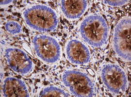 MUC1 Antibody in Immunohistochemistry (Paraffin) (IHC (P))