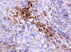 MUC1 Antibody in Immunohistochemistry (Paraffin) (IHC (P))