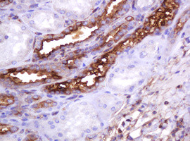 MUC1 Antibody in Immunohistochemistry (Paraffin) (IHC (P))