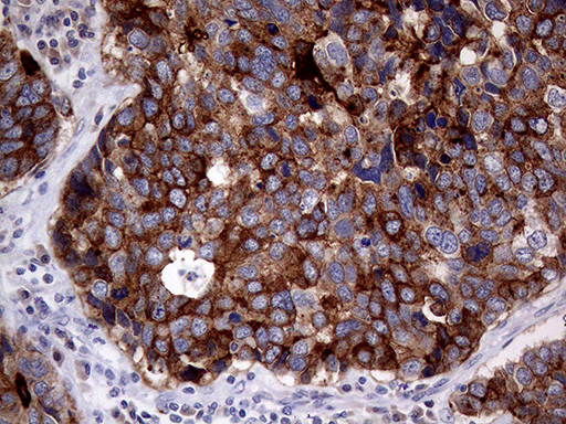 MUC1 Antibody in Immunohistochemistry (Paraffin) (IHC (P))