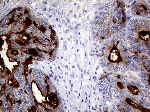 MUC1 Antibody in Immunohistochemistry (Paraffin) (IHC (P))