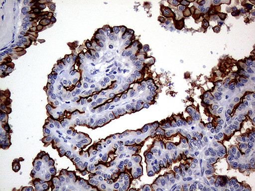 MUC1 Antibody in Immunohistochemistry (Paraffin) (IHC (P))