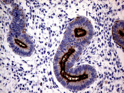 MUC1 Antibody in Immunohistochemistry (Paraffin) (IHC (P))