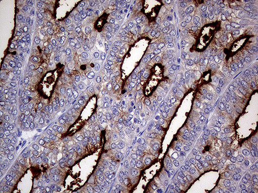 MUC1 Antibody in Immunohistochemistry (Paraffin) (IHC (P))