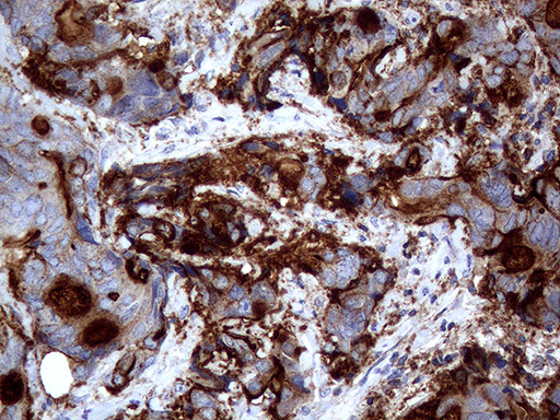 MUC1 Antibody in Immunohistochemistry (Paraffin) (IHC (P))