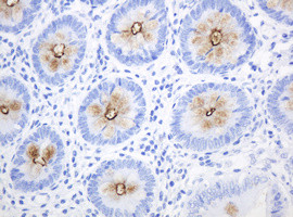 MUC1 Antibody in Immunohistochemistry (Paraffin) (IHC (P))