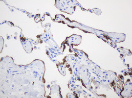 MUC1 Antibody in Immunohistochemistry (Paraffin) (IHC (P))