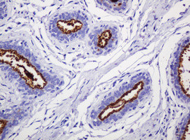 MUC1 Antibody in Immunohistochemistry (Paraffin) (IHC (P))