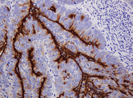 MUC1 Antibody in Immunohistochemistry (Paraffin) (IHC (P))