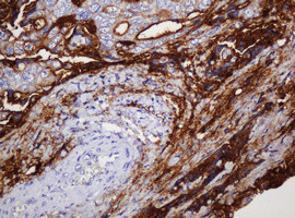 MUC1 Antibody in Immunohistochemistry (Paraffin) (IHC (P))