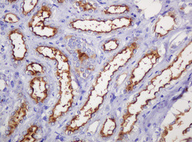 MUC1 Antibody in Immunohistochemistry (Paraffin) (IHC (P))