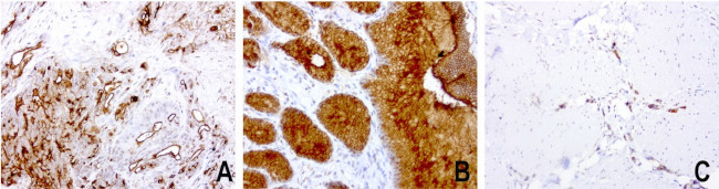 MUC1 Antibody in Immunohistochemistry (Paraffin) (IHC (P))